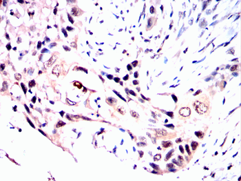 TOP1 Antibody