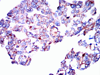 SGCG Antibody