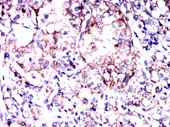 SGCG Antibody