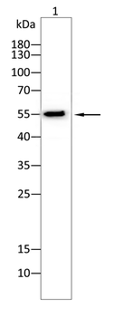 SGCG Antibody