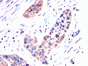 FTH1 Antibody
