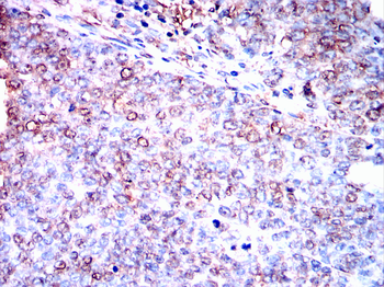FTH1 Antibody
