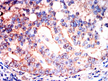 FTH1 Antibody