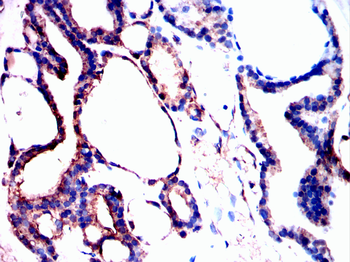 FTH1 Antibody