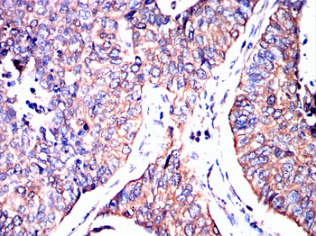 HP Antibody