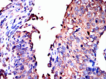 HP Antibody