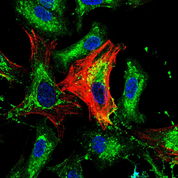 MYL2 Antibody