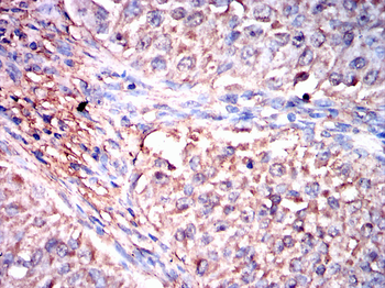 MYL2 Antibody