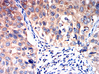 MYL2 Antibody