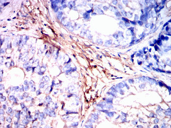 MYL2 Antibody