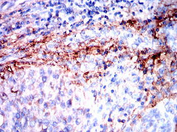 GCLM Antibody