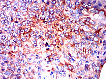 GCLM Antibody
