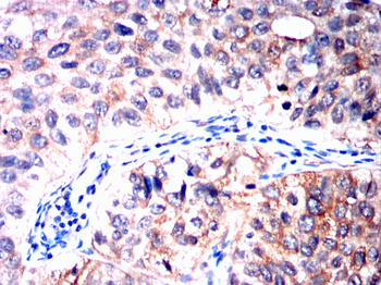 GCLM Antibody