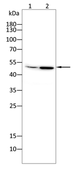 GCLM Antibody