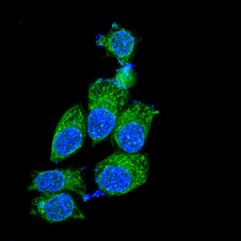 FHIT Antibody