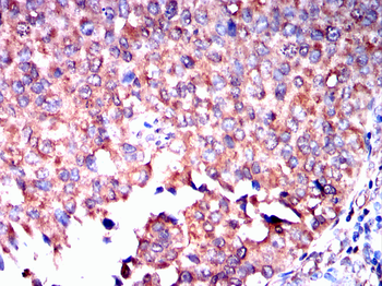 FHIT Antibody