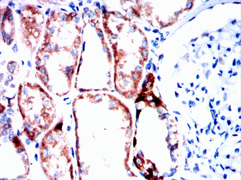 FHIT Antibody