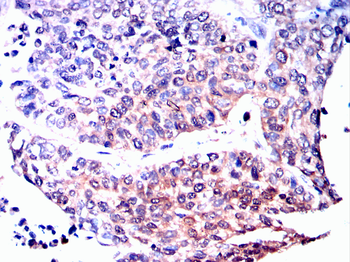 FHIT Antibody