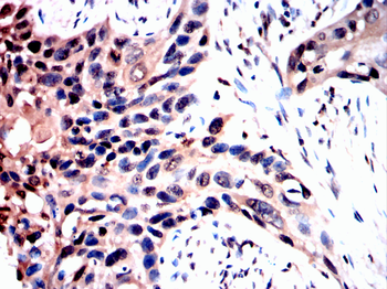 FHIT Antibody