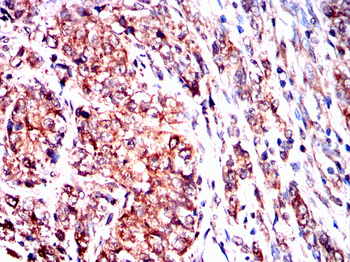 FHIT Antibody