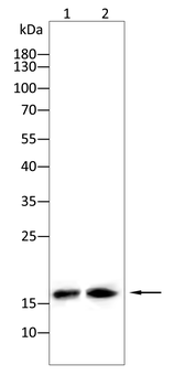 FHIT Antibody