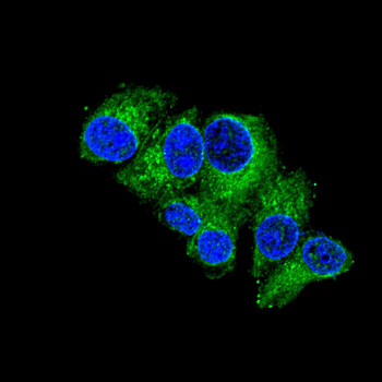 ADK Antibody
