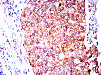ADK Antibody