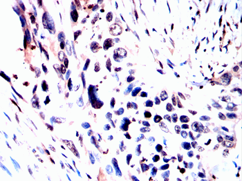 ADK Antibody