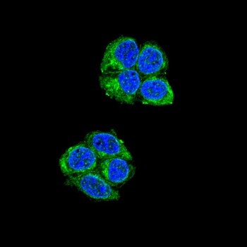 ME2 Antibody