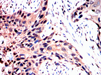 USP11 Antibody