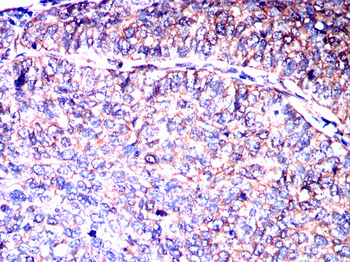 MKRN2 Antibody