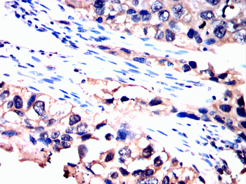 MKRN2 Antibody