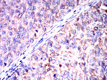MKRN2 Antibody