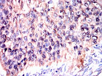 MKRN2 Antibody