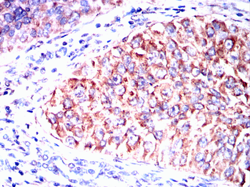 TERF2IP Antibody