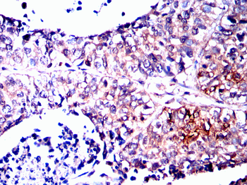 TERF2IP Antibody