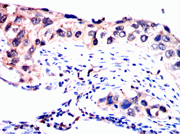 TERF2IP Antibody