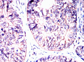 TERF2IP Antibody