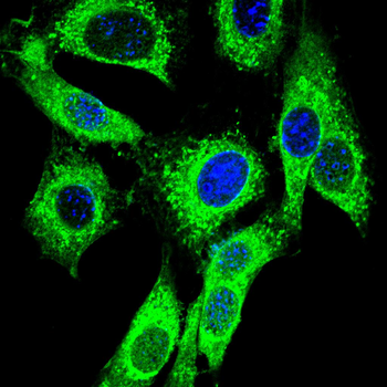 PPT1 Antibody