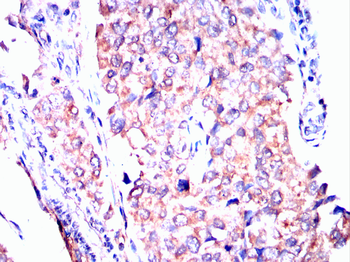 PPT1 Antibody