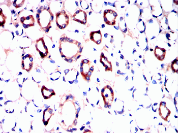 PPT1 Antibody