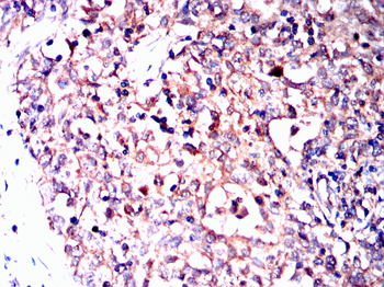 PPT1 Antibody