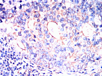 PPT1 Antibody