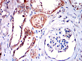 RAB5C Antibody