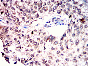 ACHE Antibody