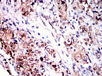 ACHE Antibody