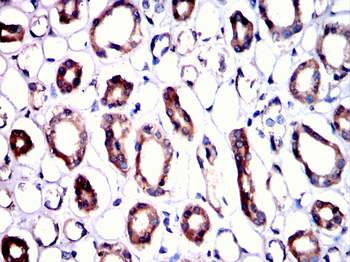 ACOX1 Antibody