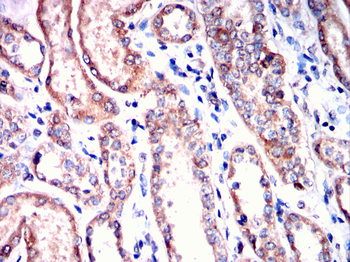 ACOX1 Antibody