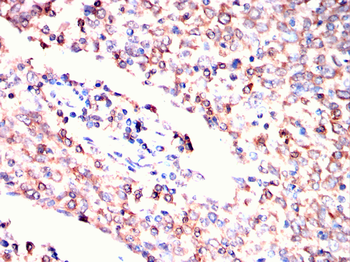 ACOX1 Antibody
