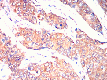 ULK3 Antibody
